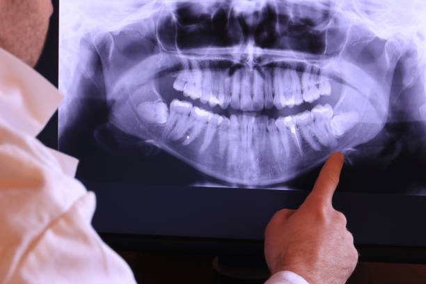 Best Emergency Treatment for Toothache in Lake Summerset, IL