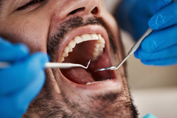 Best Emergency Broken Tooth Repair in Lake Summerset, IL